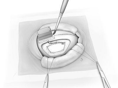 Fig23.jpg