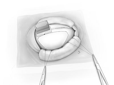 Fig26.jpg