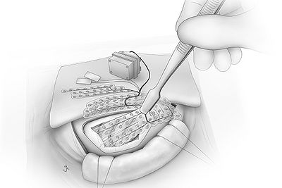 Fig18.jpg