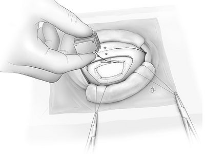 Fig20.jpg