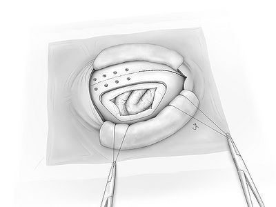 Fig17.jpg