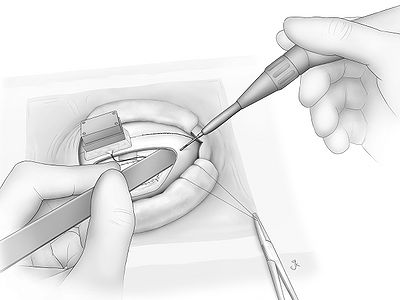 Fig24.jpg