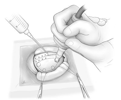 Fig6.jpg