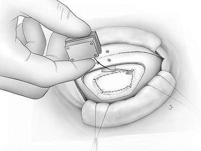 Fig22.jpg