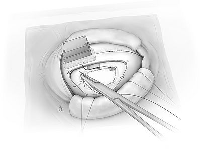Fig25.jpg