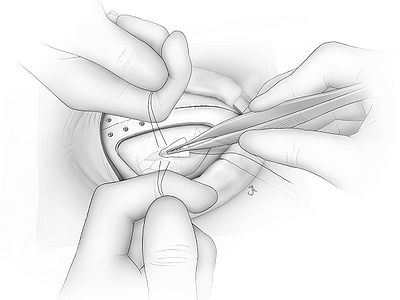 Fig15.jpg