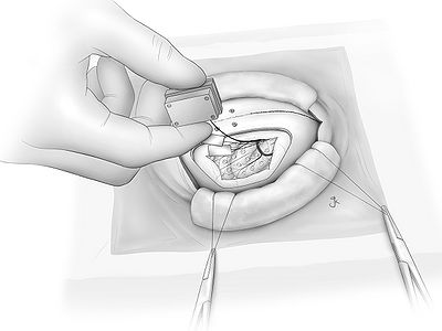 Fig19.jpg